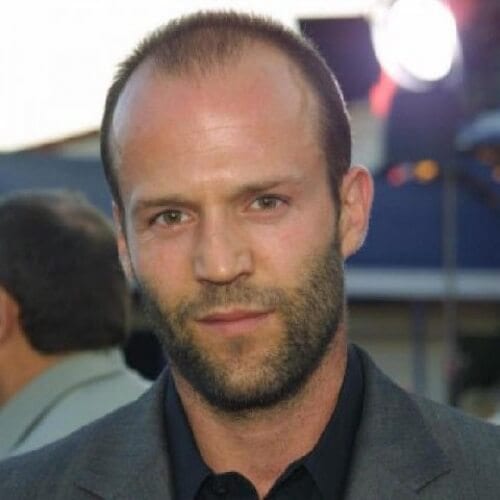 Hairstyles For Balding Men